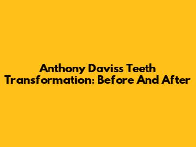 Anthony Davis's Teeth Transformation: Before And After