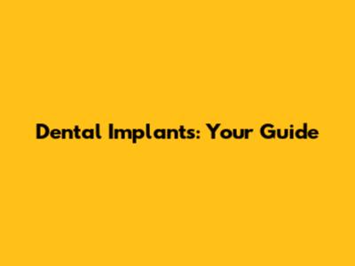 Dental Implants: Your Guide