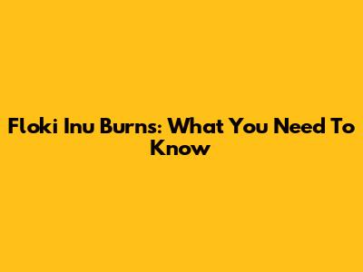 Floki Inu Burns: What You Need To Know