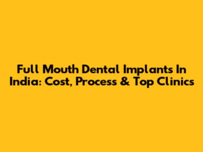 Full Mouth Dental Implants In India: Cost, Process & Top Clinics