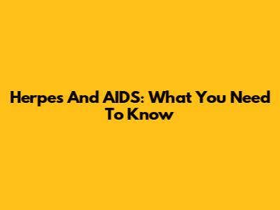 Herpes And AIDS: What You Need To Know