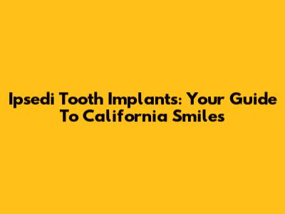 Ipsedi Tooth Implants: Your Guide To California Smiles