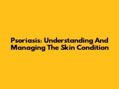 Psoriasis: Understanding And Managing The Skin Condition