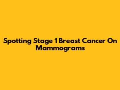 Spotting Stage 1 Breast Cancer On Mammograms